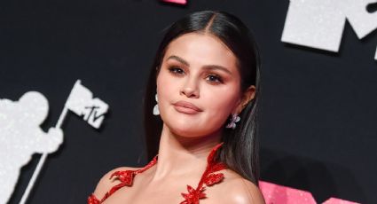 Cómo conseguir los labios “aesthetic” al estilo de Selena Gómez 