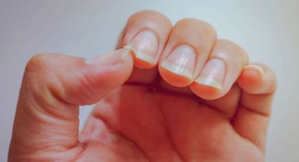 Los cinco remedios naturales para mejorar el aspecto de tus uñas