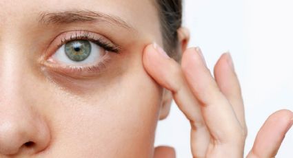 Los mejores tips para disimular las ojeras