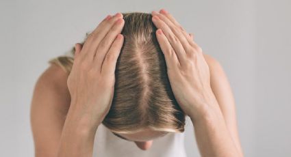 Pérdida de cabello en mujeres: causas y tratamientos efectivos