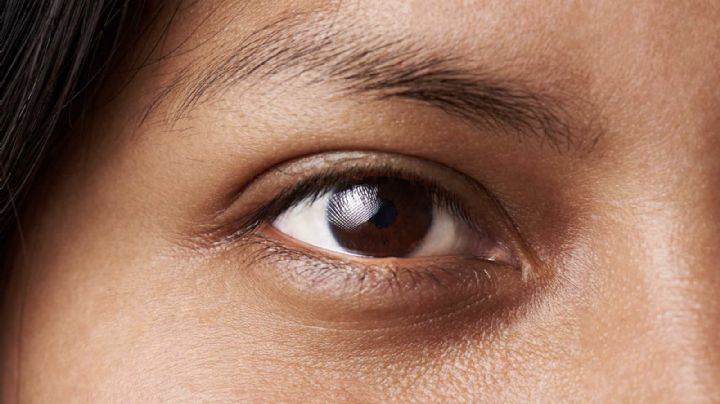 Cómo eliminar las ojeras y recuperar una mirada luminosa y joven