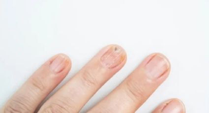 Cómo deshacerte de las uñas amarillentas