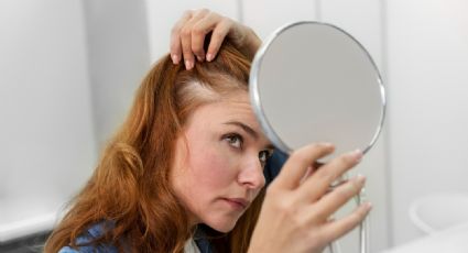 Controla la alopecia de forma natural con estos remedios